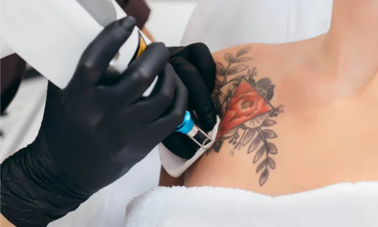 Debunking Myths About Tattoo Removal Techniques